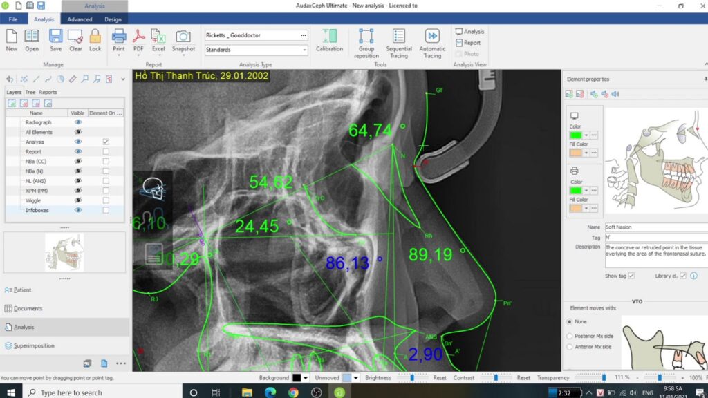 AudaxCeph Ultimate 2025 Full Version