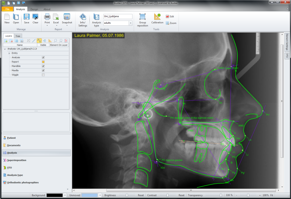 
AudaxCeph Ultimate 2025 Full Version Show