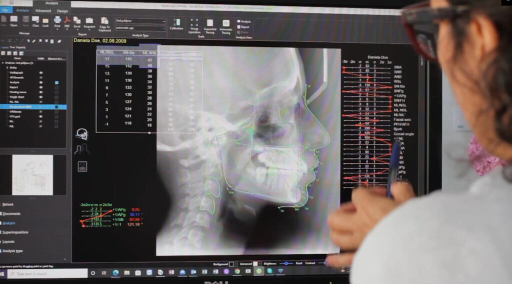 AudaxCeph Ultimate 2025 - Lifetime License for Orthodontists