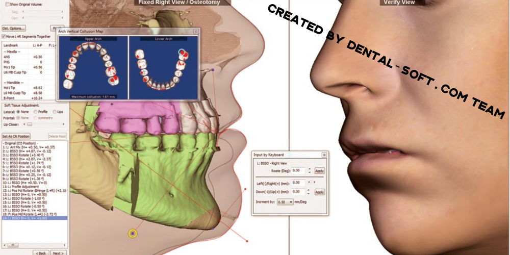 Dolphin Imaging 3D Dental v12 new modules