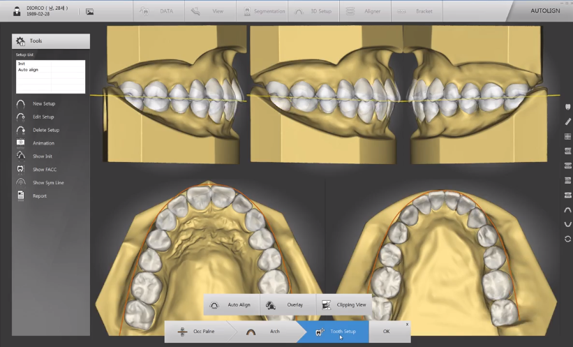Diorco Autolign Dental photo