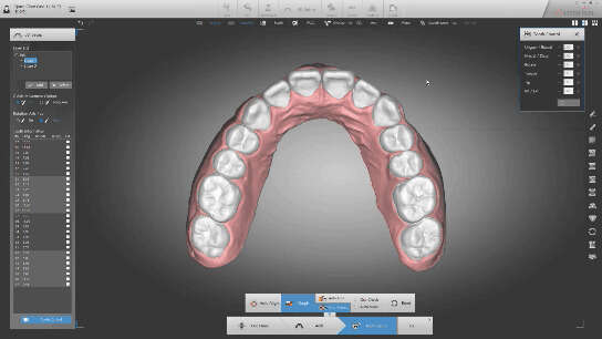 Diorco Autolign Dental screenshot