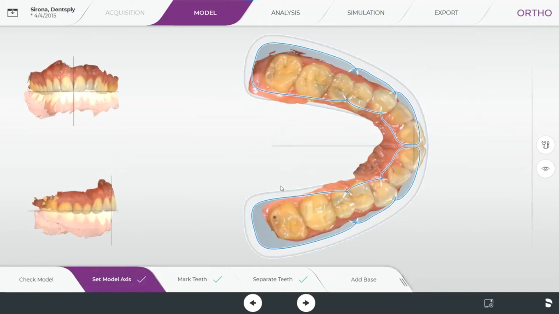 CEREC Ortho 2.0 Software photo 1