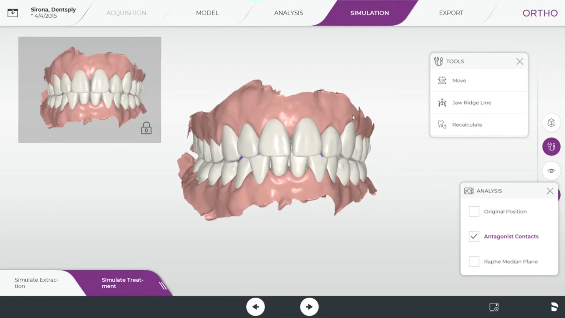CEREC Ortho 2.0 Software photo 2