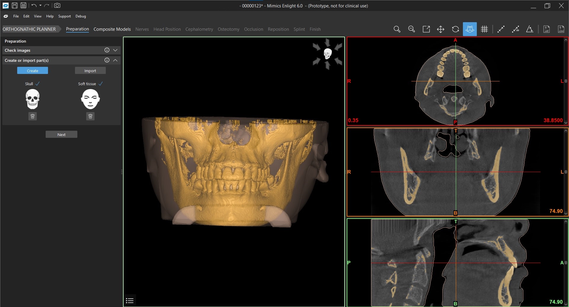 Mimics Enlight 6.0 Software design