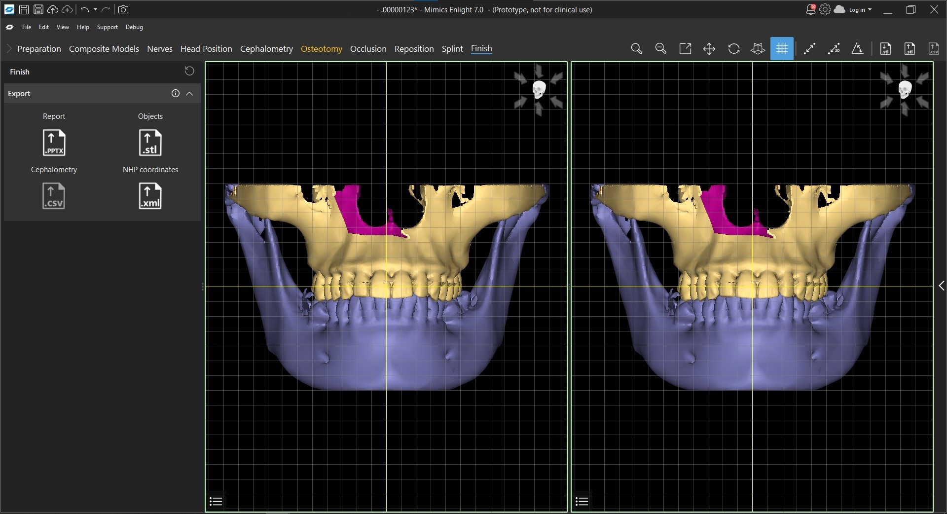Mimics Enlight 7.0 Software - Lifetime License