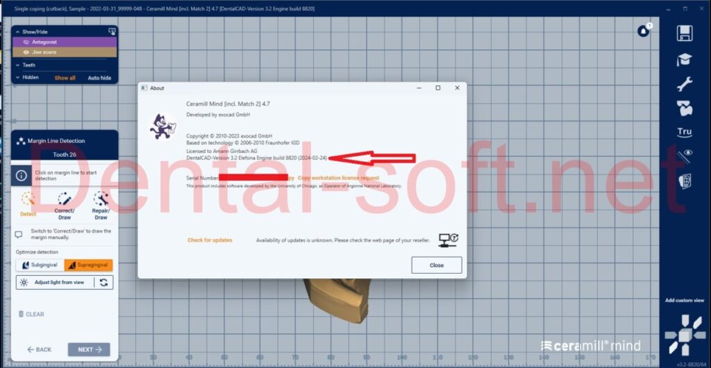 Ceramill Amann Girrbach Software CAD