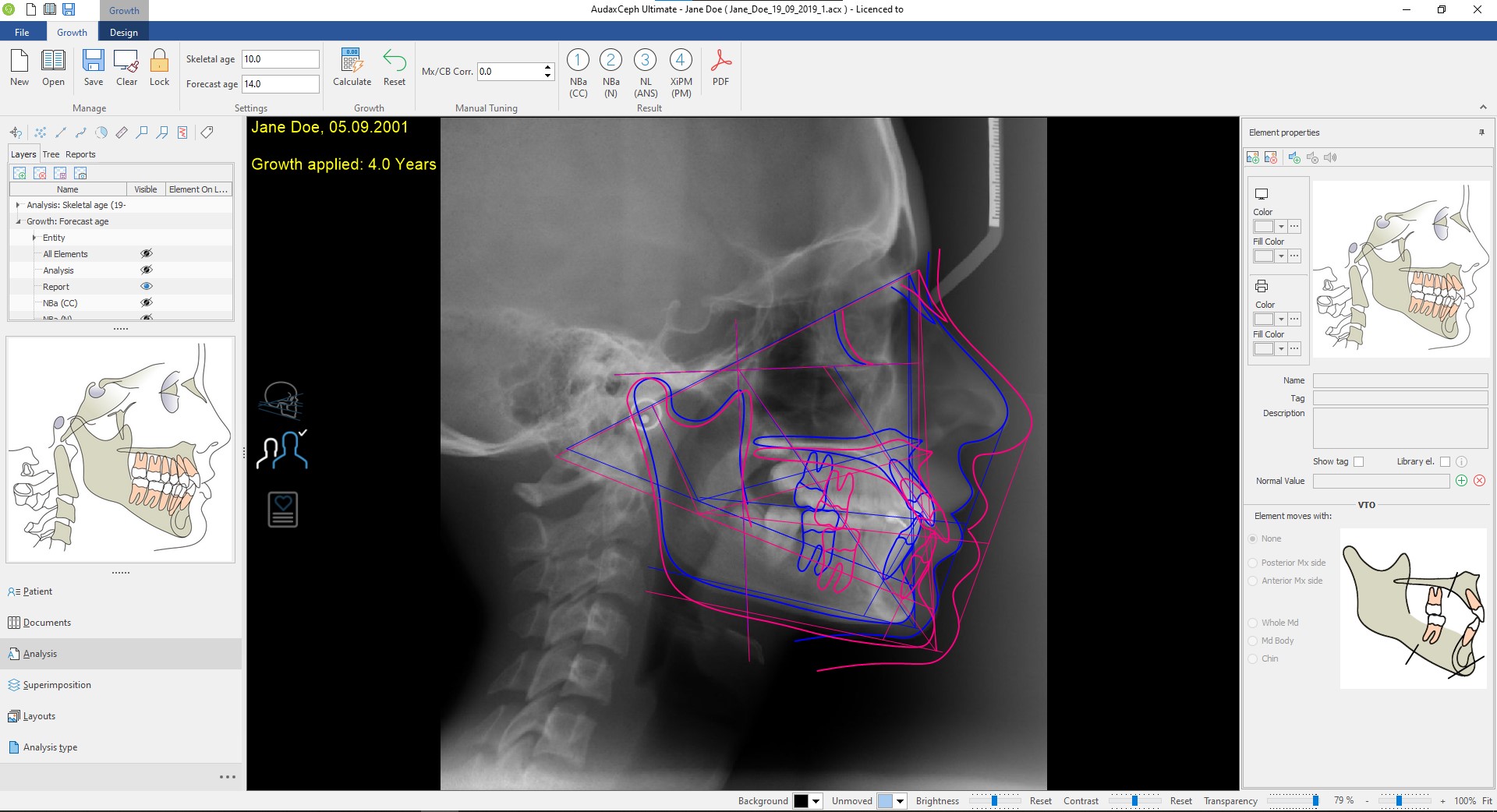 AudaxCeph Ultimate Full Crack