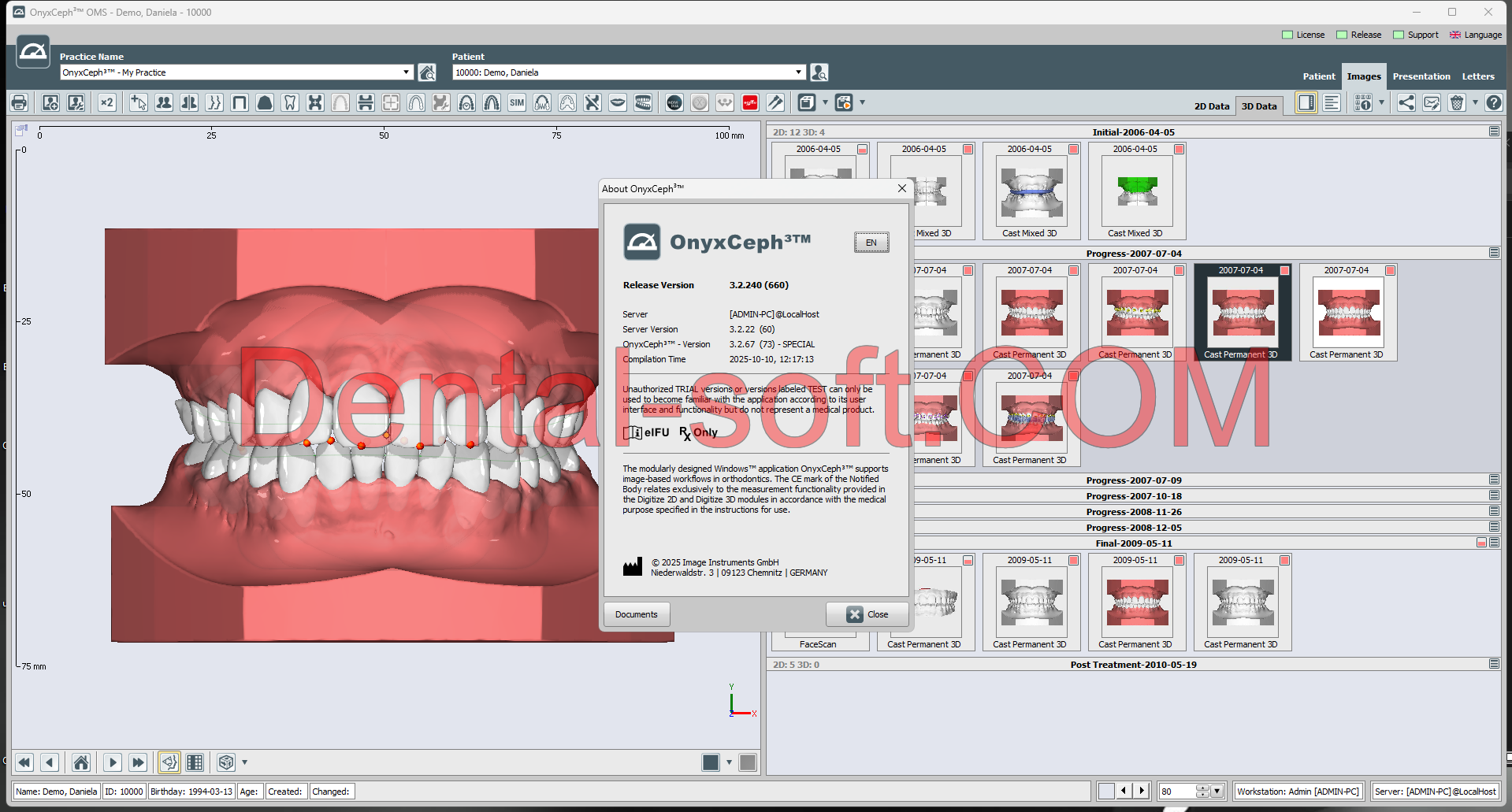OnyxCeph 2025 Full Crack version