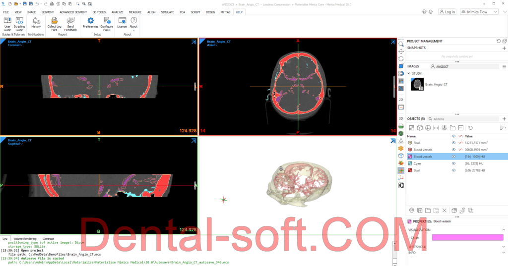 Materialise Mimics 28.0 crack design